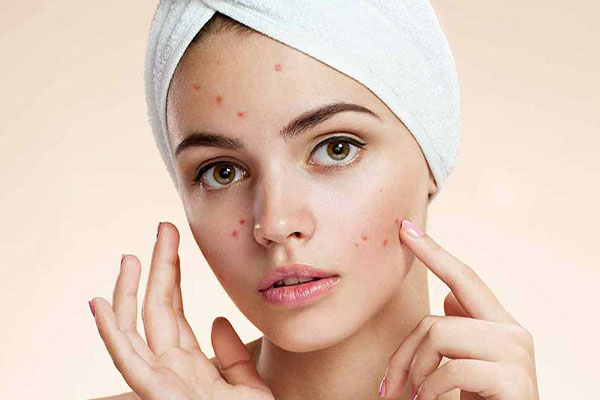 پاکسازی پوست جوشدار قبل از آرایش؛ اصلی مهم که باید رعایت کنید- زیبابست